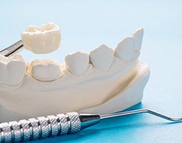 Ceramic restoration, mouth mold, and dental instruments